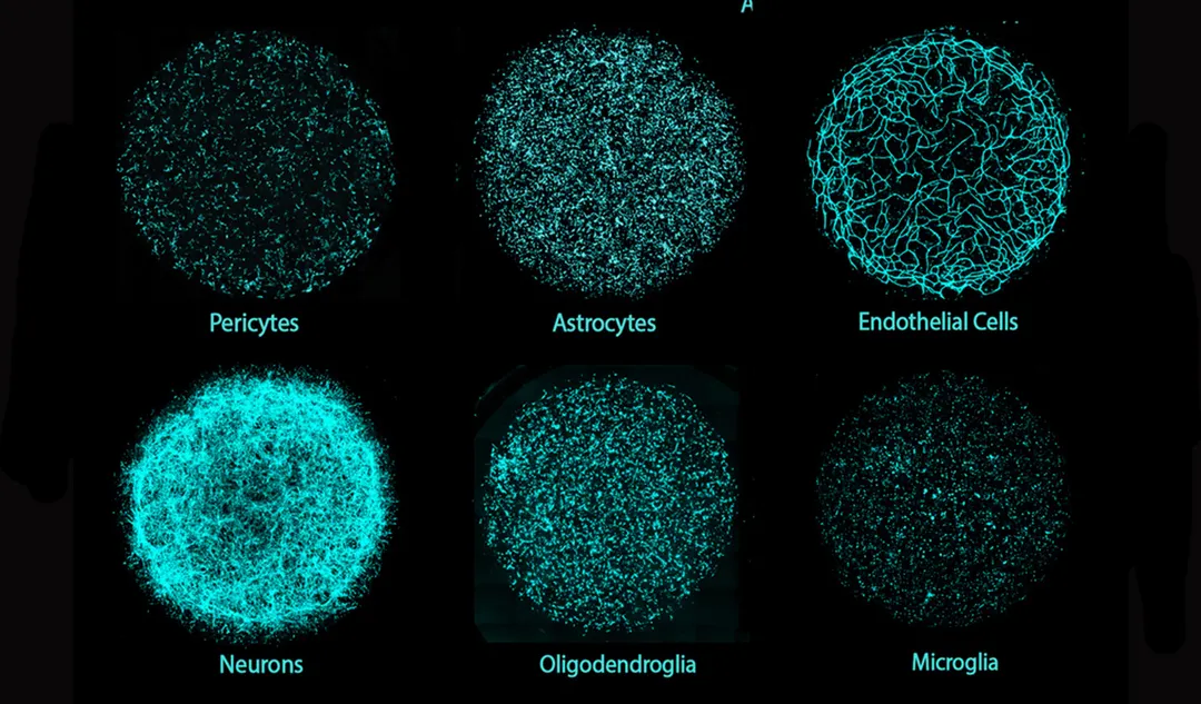 miBrain es un modelo que por primera vez integra los principales seis tipos de células del cerebro humano en una estructura cultivada en laboratorio: neuronas, astrocitos, oligodendroglia, microglía, células endoteliales y pericitos. Créditos: Instituto Tecnológico de Massachusetts
