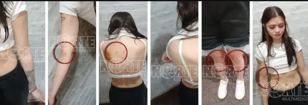Las imágenes de las heridas de Victoria Cantero.