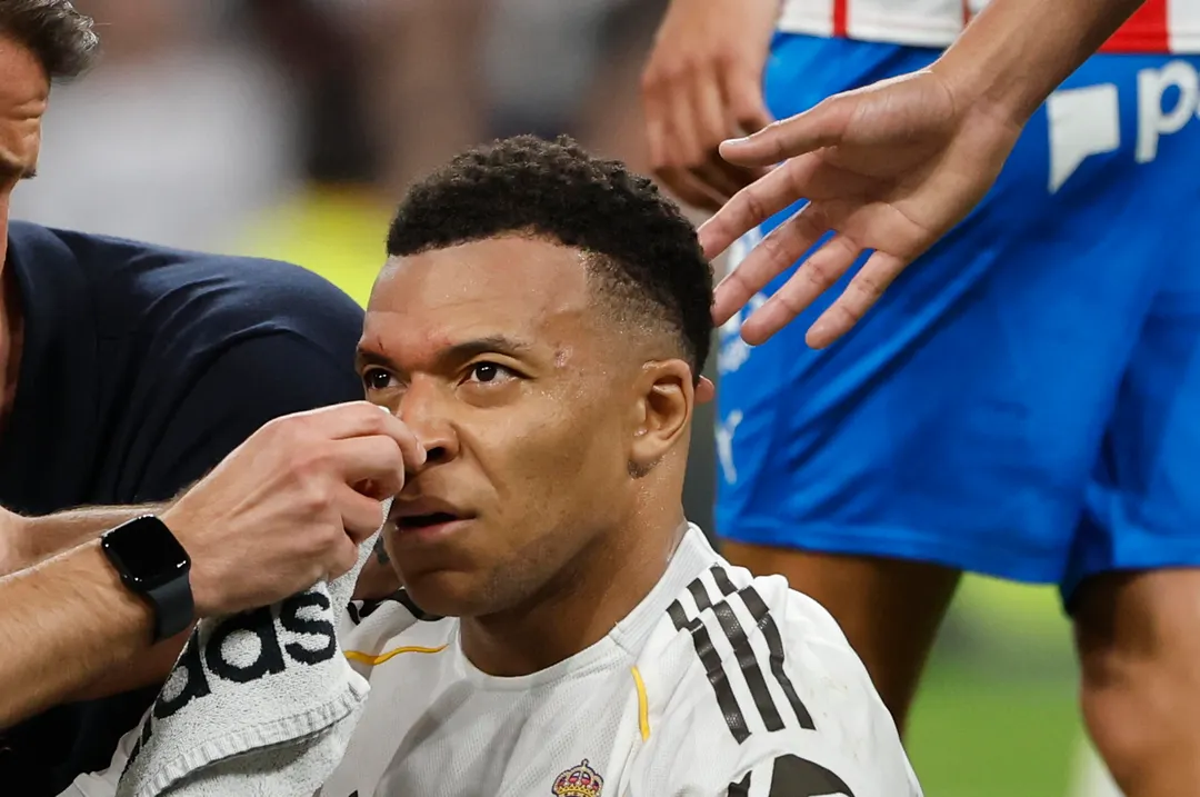 El delantero del Real Madrid Kylian Mbappé recibió un duro golpe durante el partido ante el Girona.