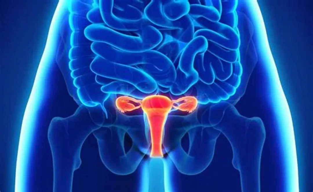 El proyecto de ley busca crear un programa especial para las pacientes con endometriosis. 