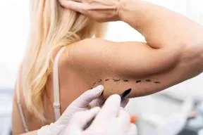 No todo brazo que incomoda necesita una cirugía.