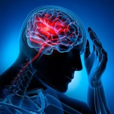 En Argentina se producen alrededor de 150.000 accidentes cerebrovasculares (ACV) cada año.