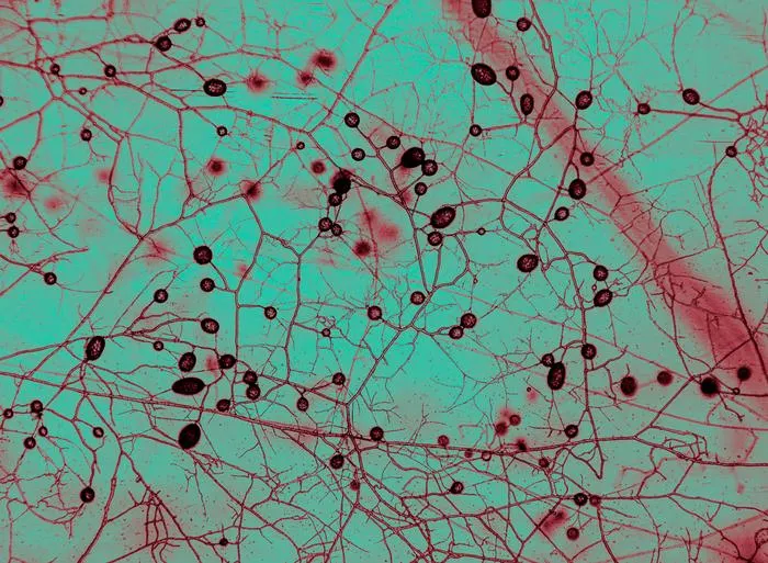 Hongos micorrícicos observados al microscopio en el instituto de biofísica AMOLF de Ámsterdam. Imagen de Tomás Munita.