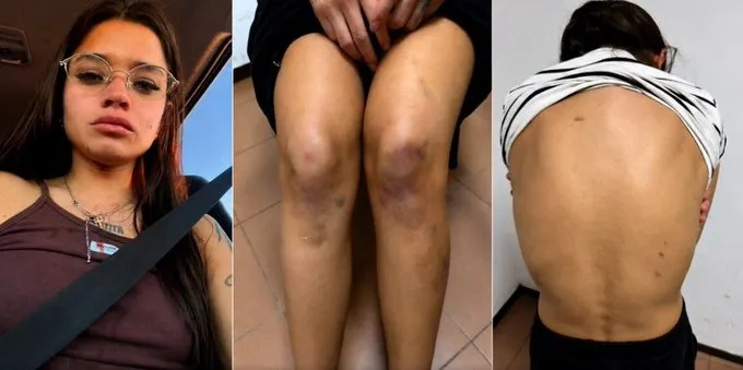 Las lesiones que habría sufrido Victoria Cantero.