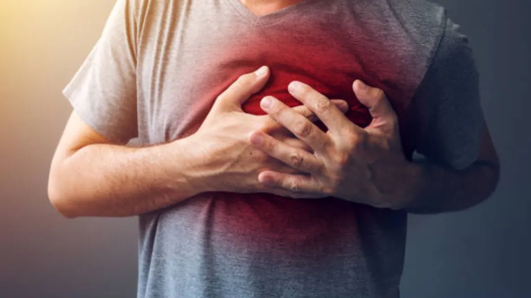 Cómo ocurre el infarto agudo de miocardio.