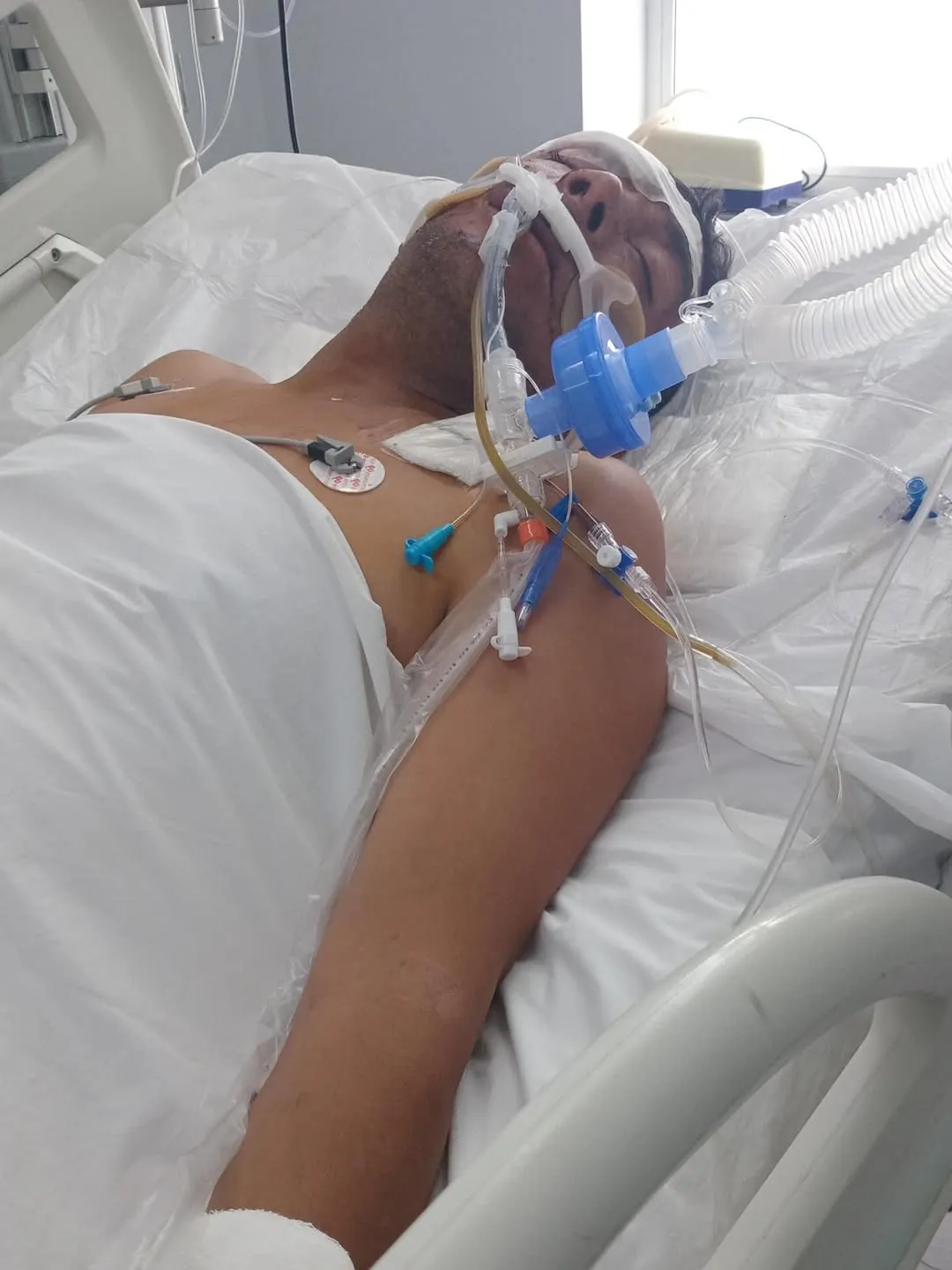 El ciclista mendocino pelea por su vida tras su accidente en San Juan.